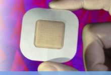 Photo of Insulin Patch Could Provide Cheap, Simple, and Effective &ldquo;Cure&rdquo; for T1D