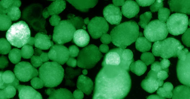 Photo of Are Immune-Evasive Islet Cells the Key to a Type 1 Cure?