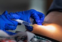 Photo of Subcutaneous Islet Transplant Provides Safer, Efficient Path for Type 1 Cure